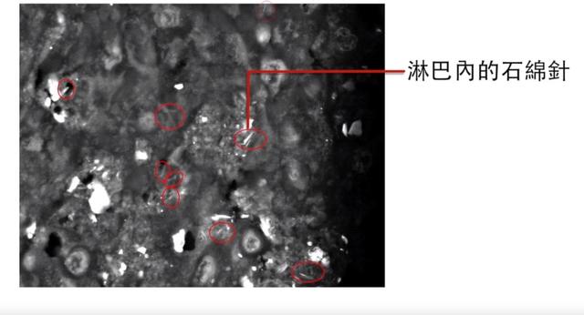 石棉被66国禁用！1Kg含有数百万根“钢针”，为什么我们国家仍然随处可见？  第22张