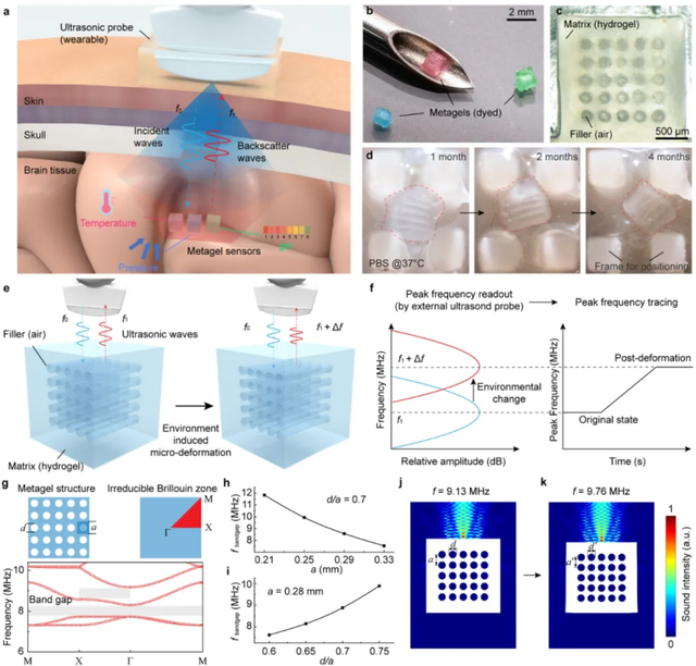 全球首创、颠覆性技术！面向颅内生理监测的可注射超声传感器登上《自然》  第4张
