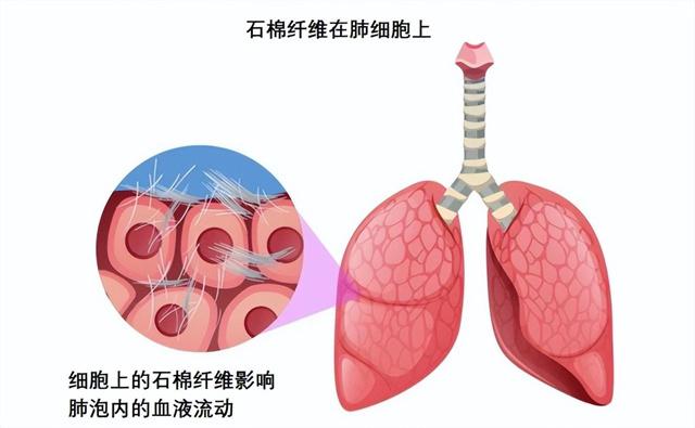 1Kg含有数百万根“钢针”！为什么66国禁用的石棉在我国随处可见？  第8张